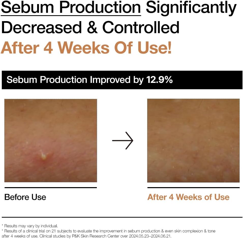 Anua Rice 70 Glow Milky Toner