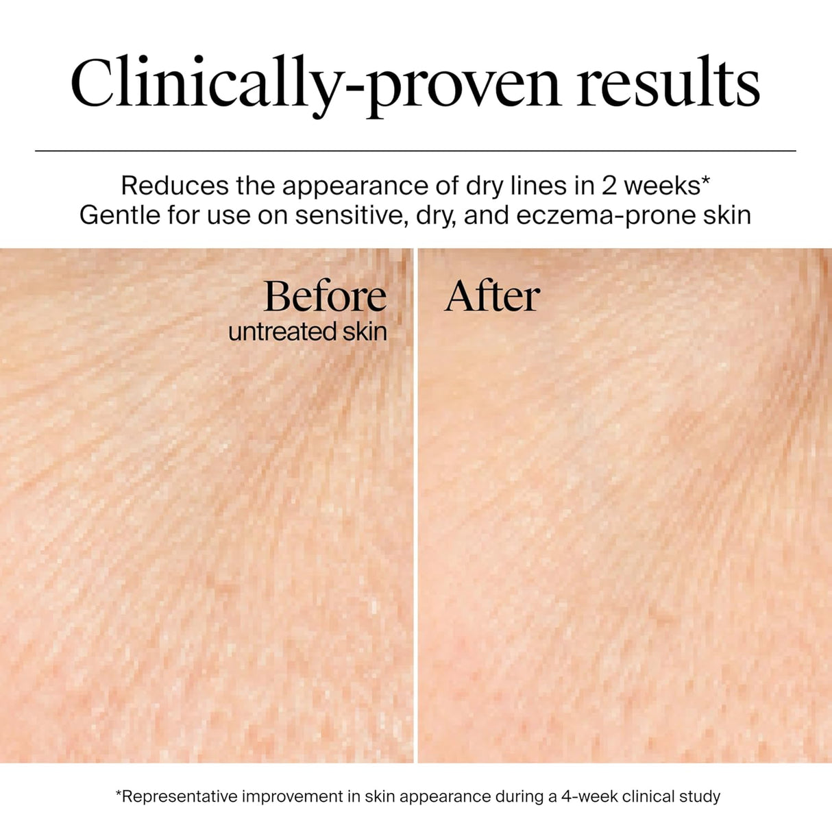 Neutrogena® Hydro Boost Water Gel