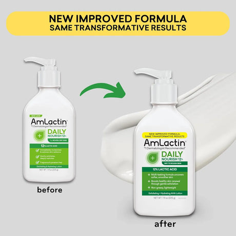 AmLactin Daily Nourish 12% Lactic Acid - Kenya
