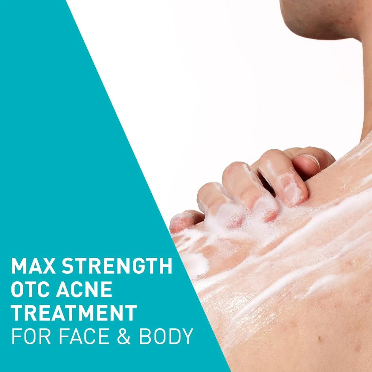 CeraVe Acne Foaming Cream Wash 10% Benzoyl Peroxide - Kenya