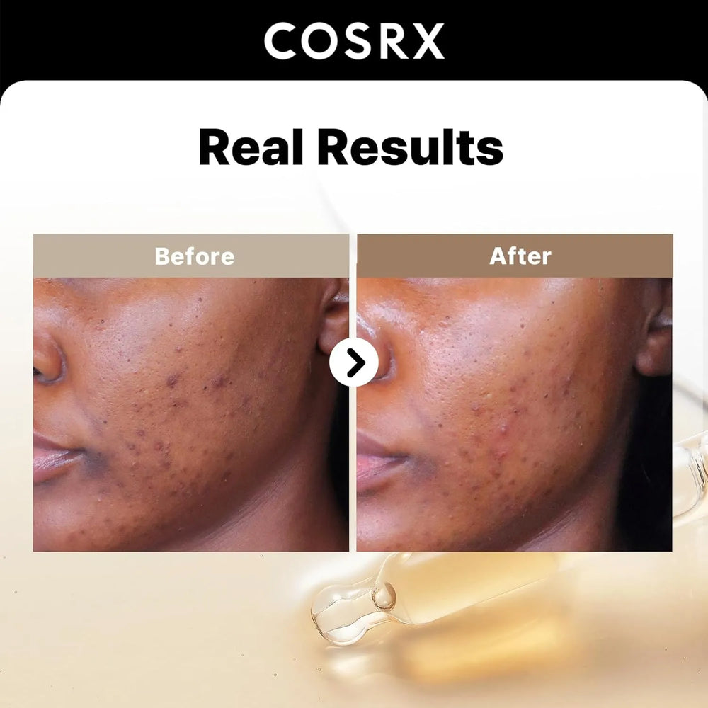 COSRX 2% Alpha Arbutin - Kenya