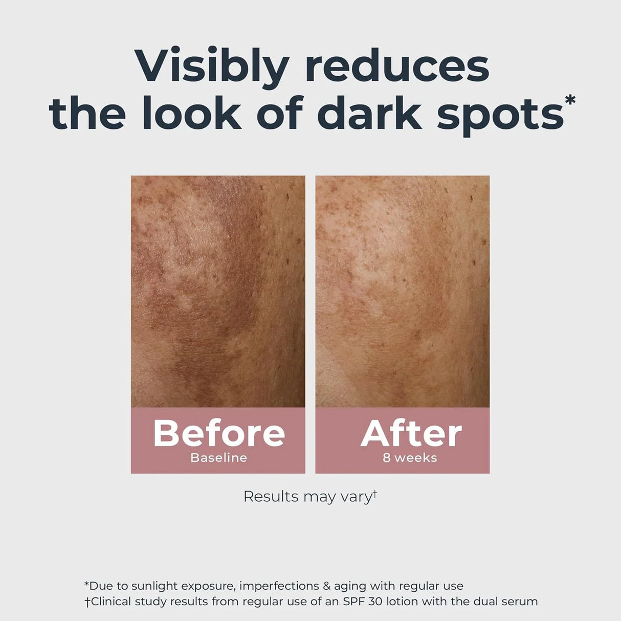 Eucerin Radiant Tone Dual Serum Dark Spot Corrector - Kenya