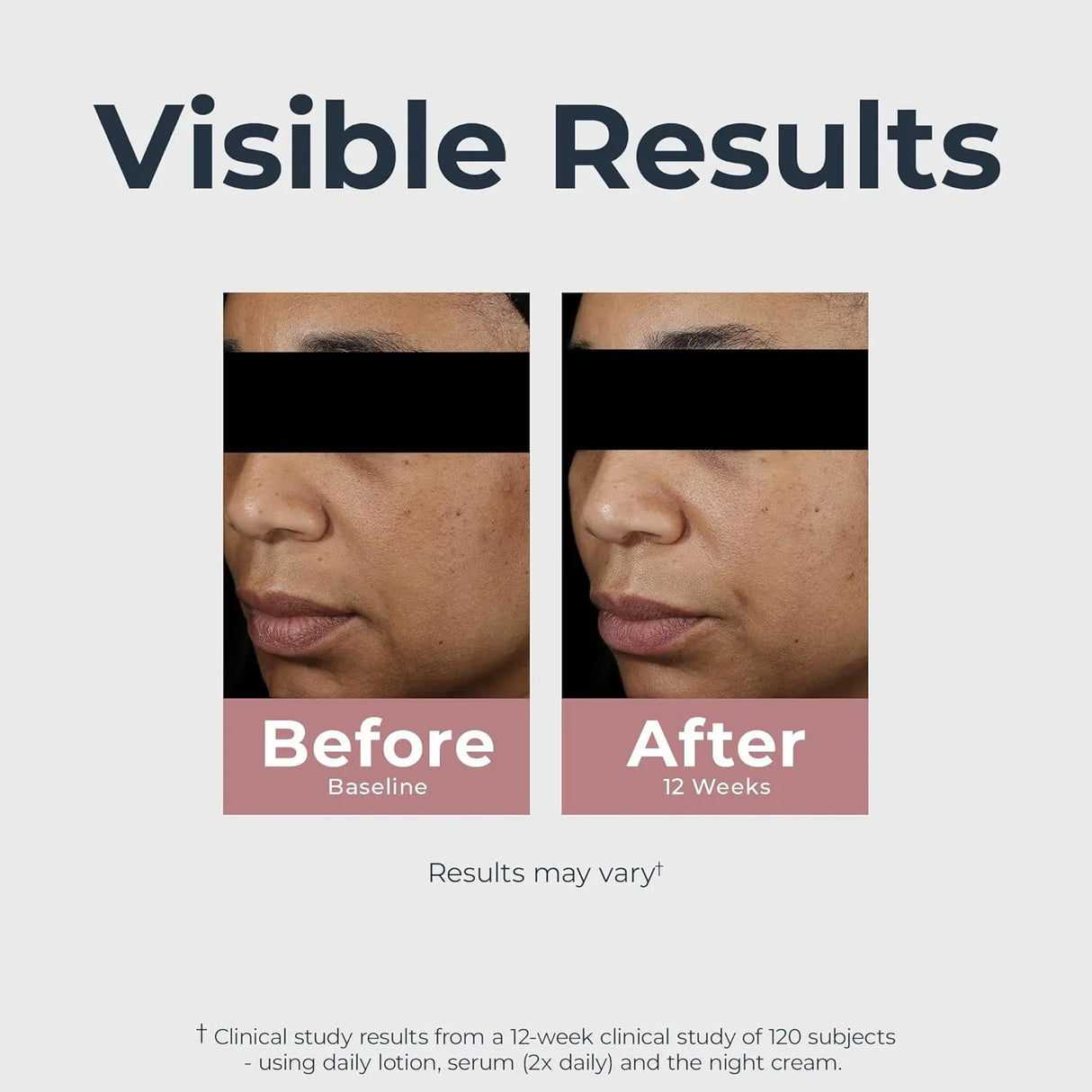 Eucerin Radiant Tone Dual Serum Dark Spot Corrector - Kenya