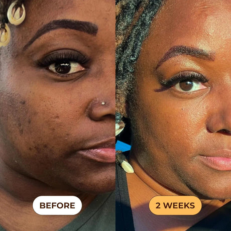 GLO Melanin Turmeric Scrub for Dark Spots Brightening - Kenya