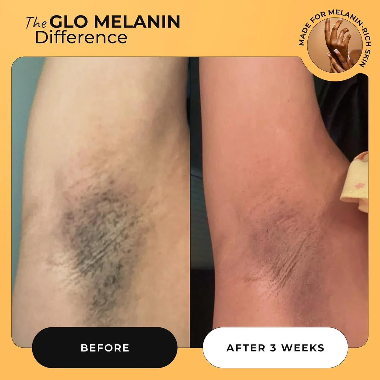 Glo Melanin Yoni Oil - Kenya