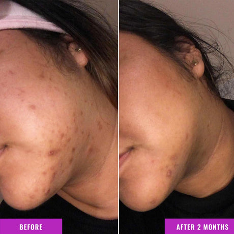 Good Molecules Discoloration Correcting Serum - Kenya