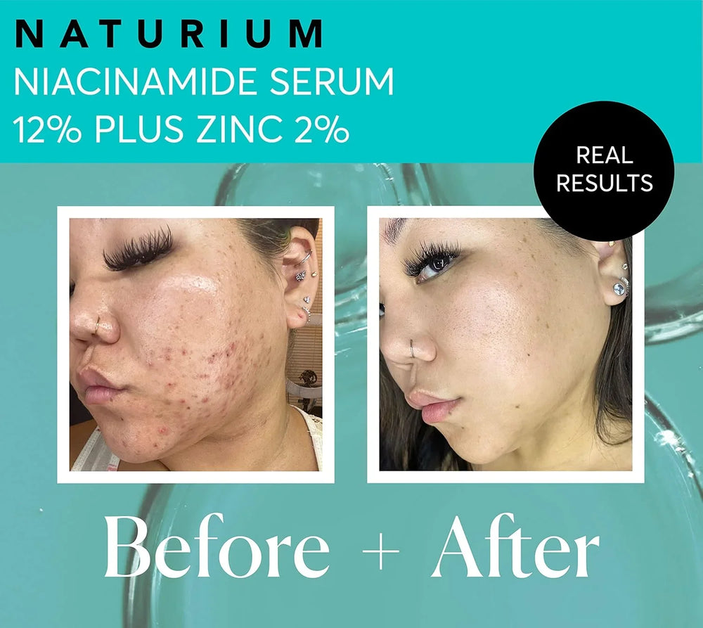 Naturium Niacinamide Face Serum 12% Plus Zinc 2% - Kenya