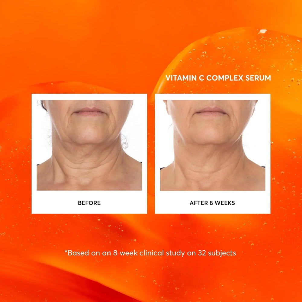 Naturium Vitamin C Complex Face Serum - Kenya