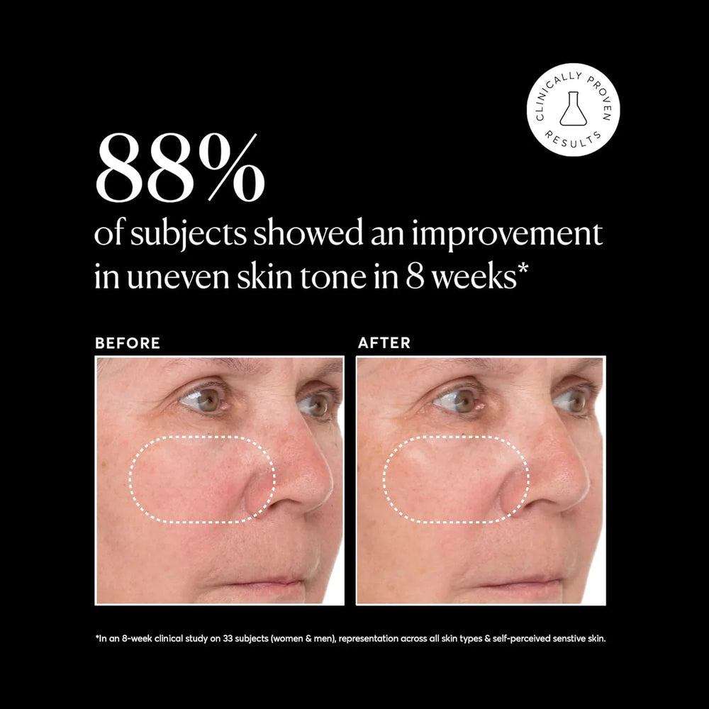 Naturium Vitamin C Super Serum Plus - Kenya