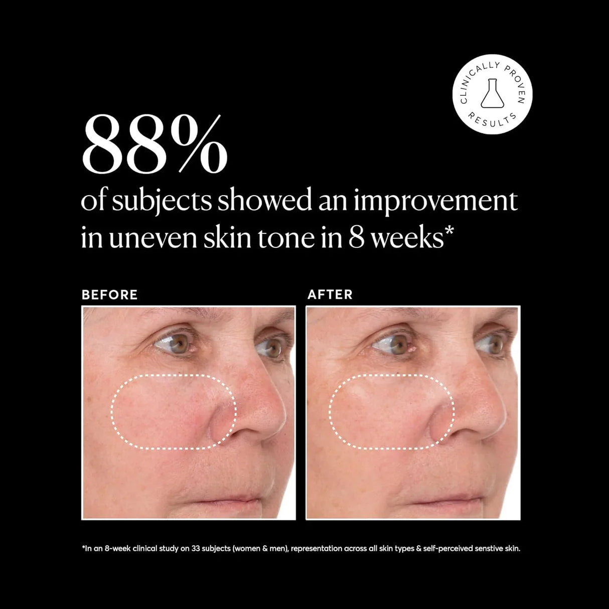 Naturium Vitamin C Super Serum Plus - Kenya