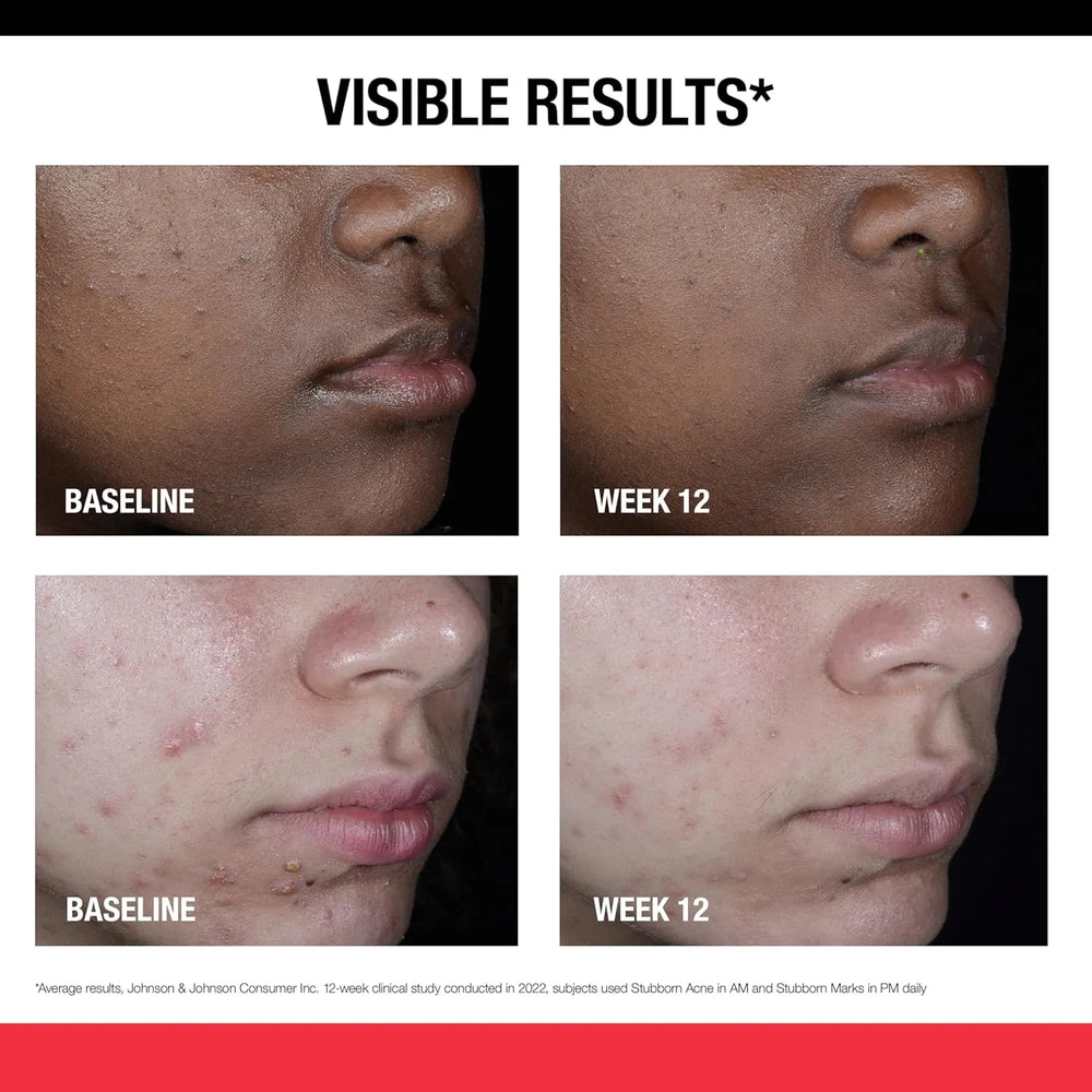 Neutrogena Retinol SA, Stubborn Marks PM Treatment - Kenya