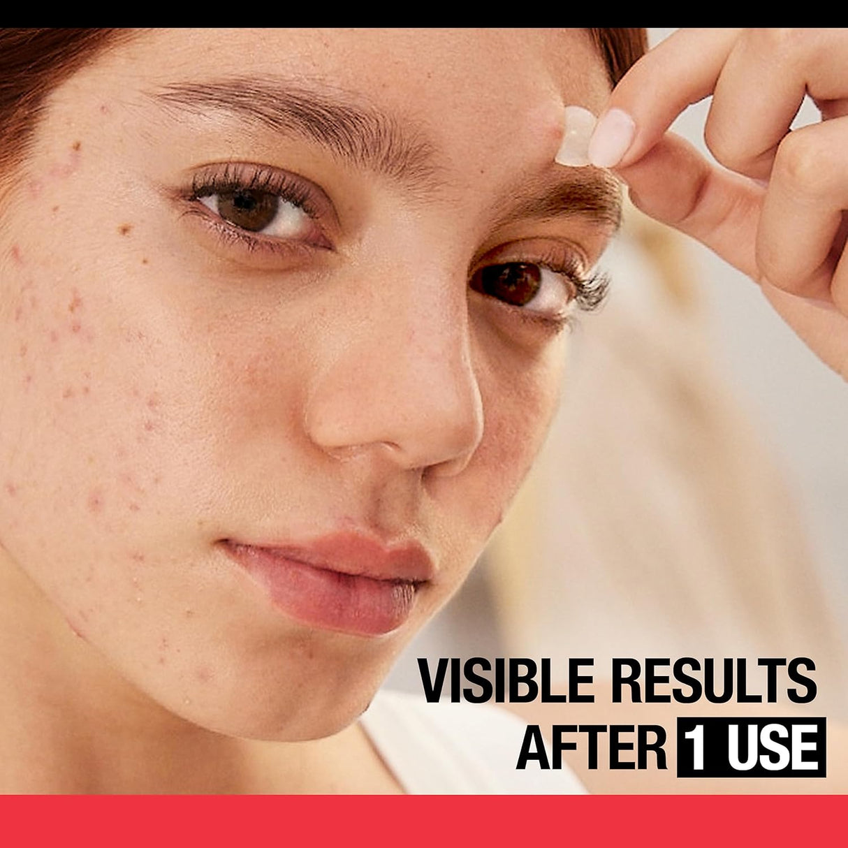 Neutrogena Stubborn Acne Pimple Patches- Kenya - Kenya