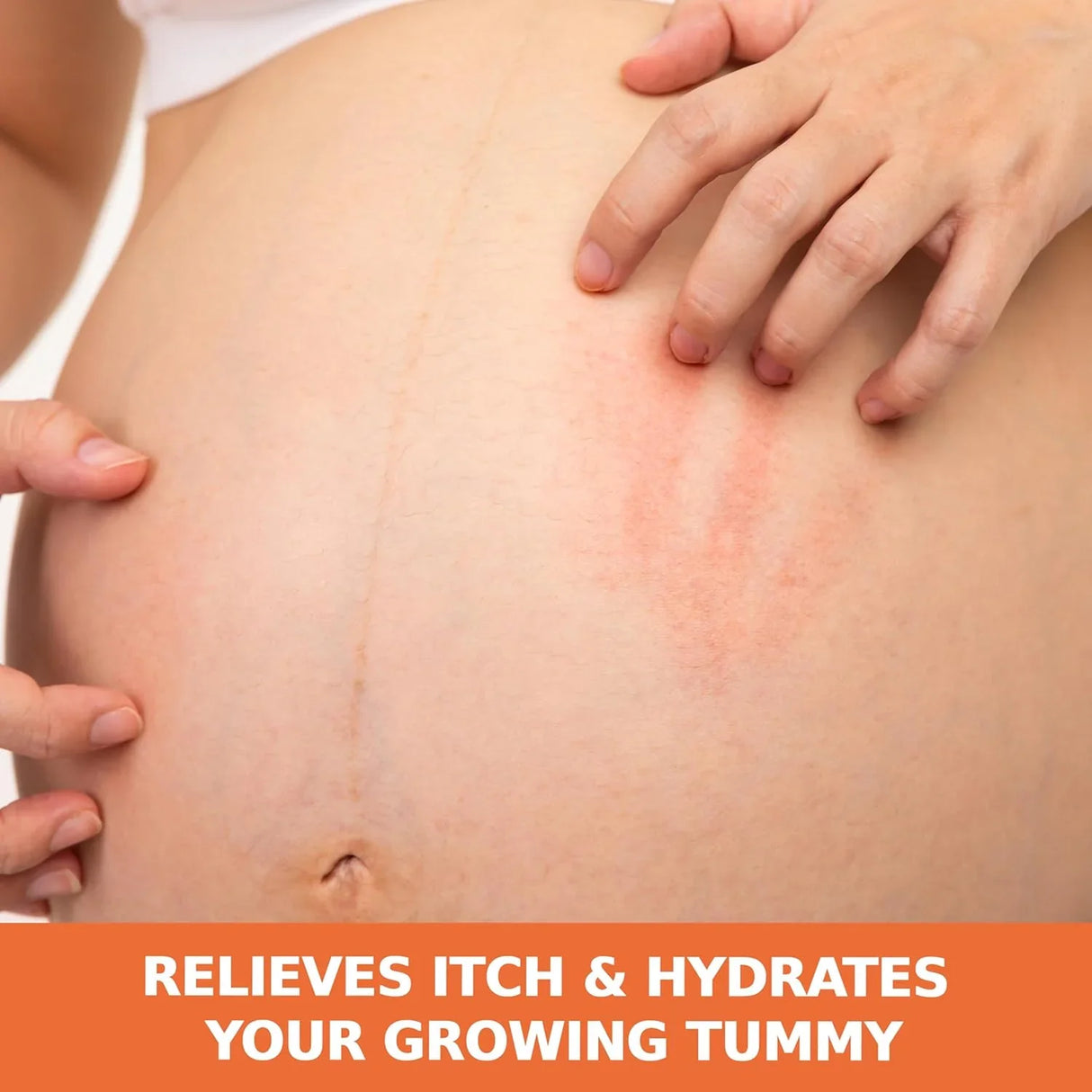 Palmer's Dry Itchy Skin Soothing Oil - Kenya