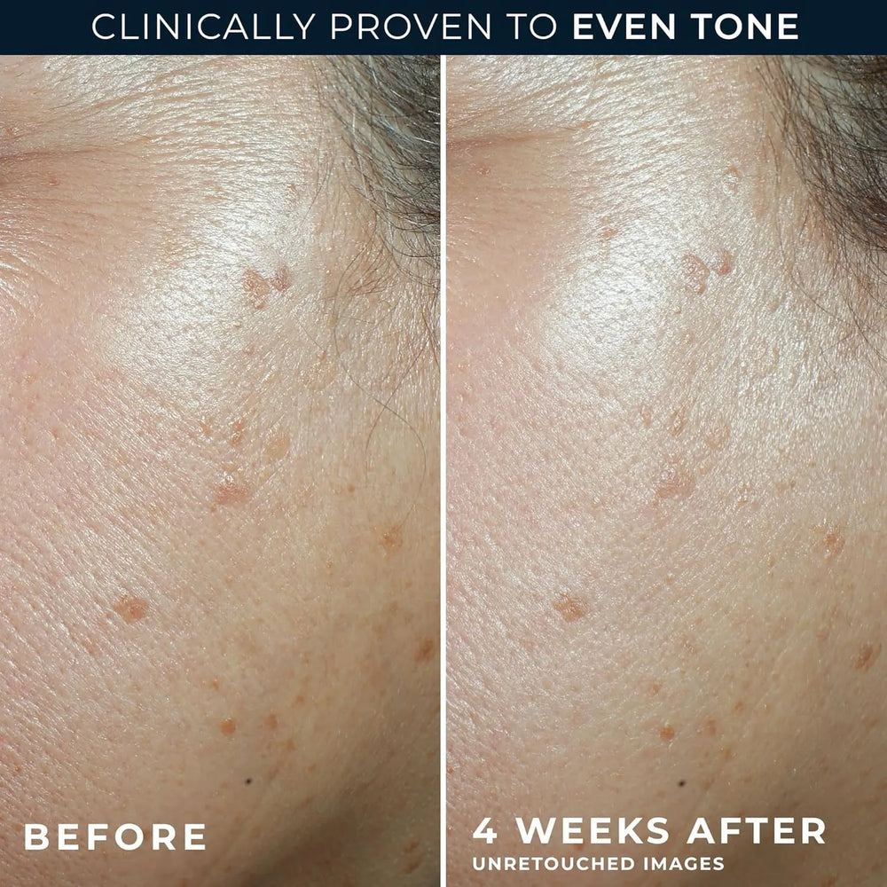 RoC Multi Correxion Even Tone + Lift Moisturizer SPF 30 - Kenya