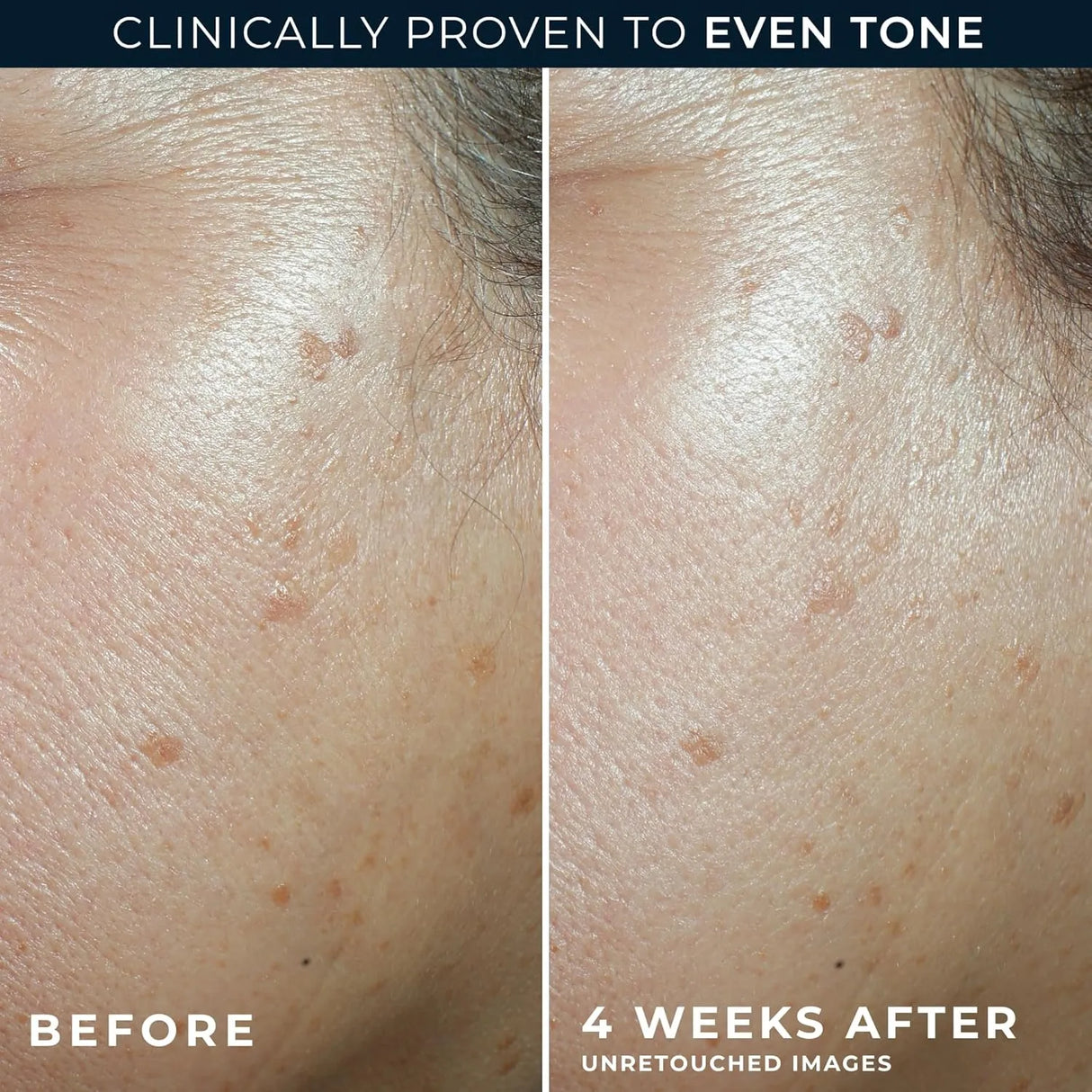 RoC Multi Correxion Even Tone + Lift Moisturizer SPF 30 - Kenya