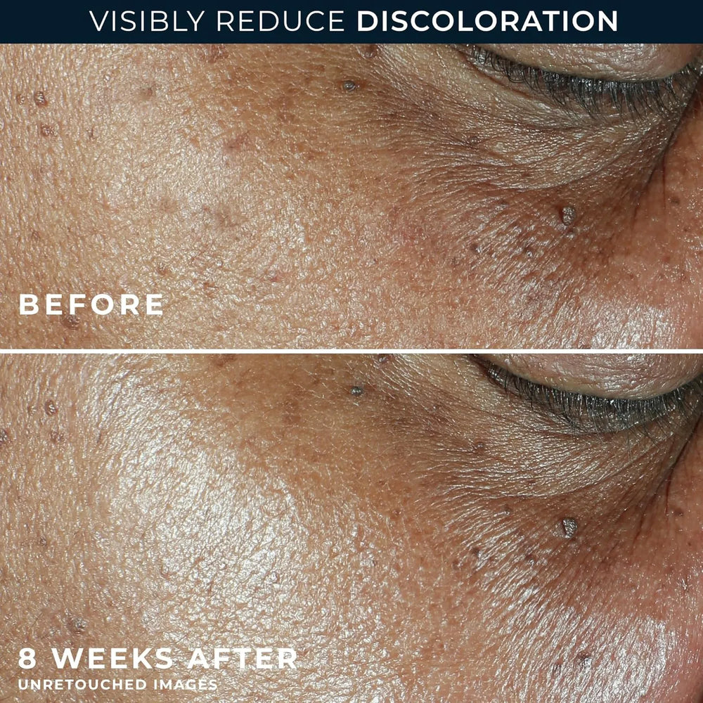 RoC Multi Correxion Even Tone + Lift Moisturizer SPF 30 - Kenya