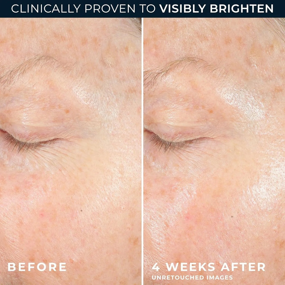 RoC Multi Correxion Revive + Glow 10% Vitamin C Face Moisturizer - Kenya