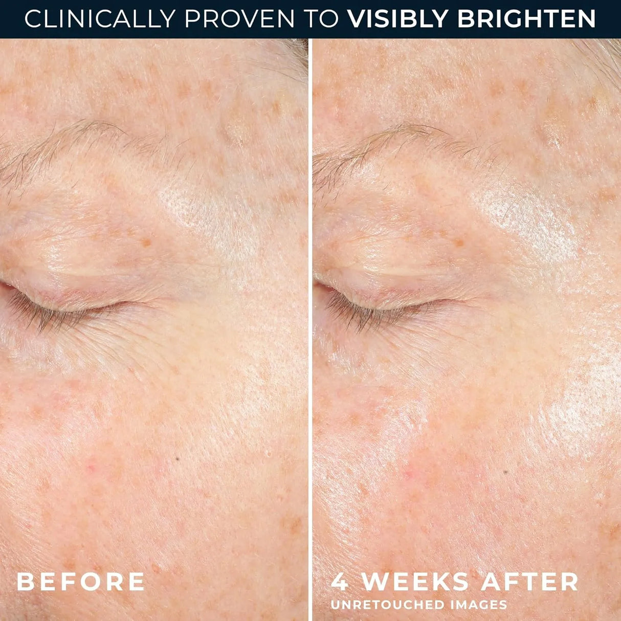 RoC Multi Correxion Revive + Glow 10% Vitamin C Face Moisturizer - Kenya