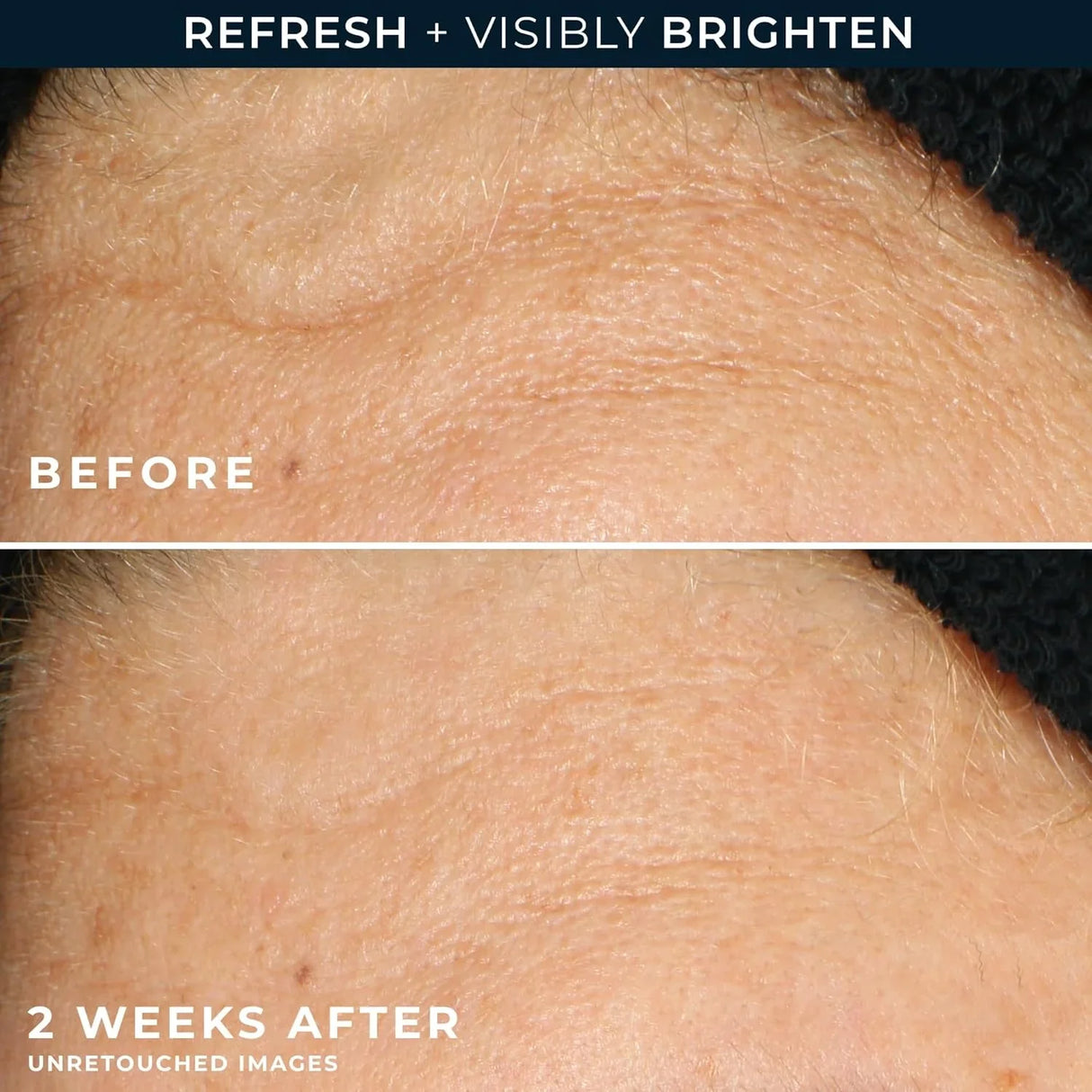 RoC Multi Correxion Revive + Glow Gel Facial Cleanser - Kenya