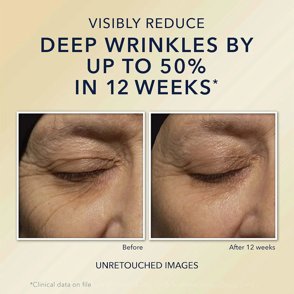 RoC Retinol Correxion Deep Wrinkle Night Cream - Kenya