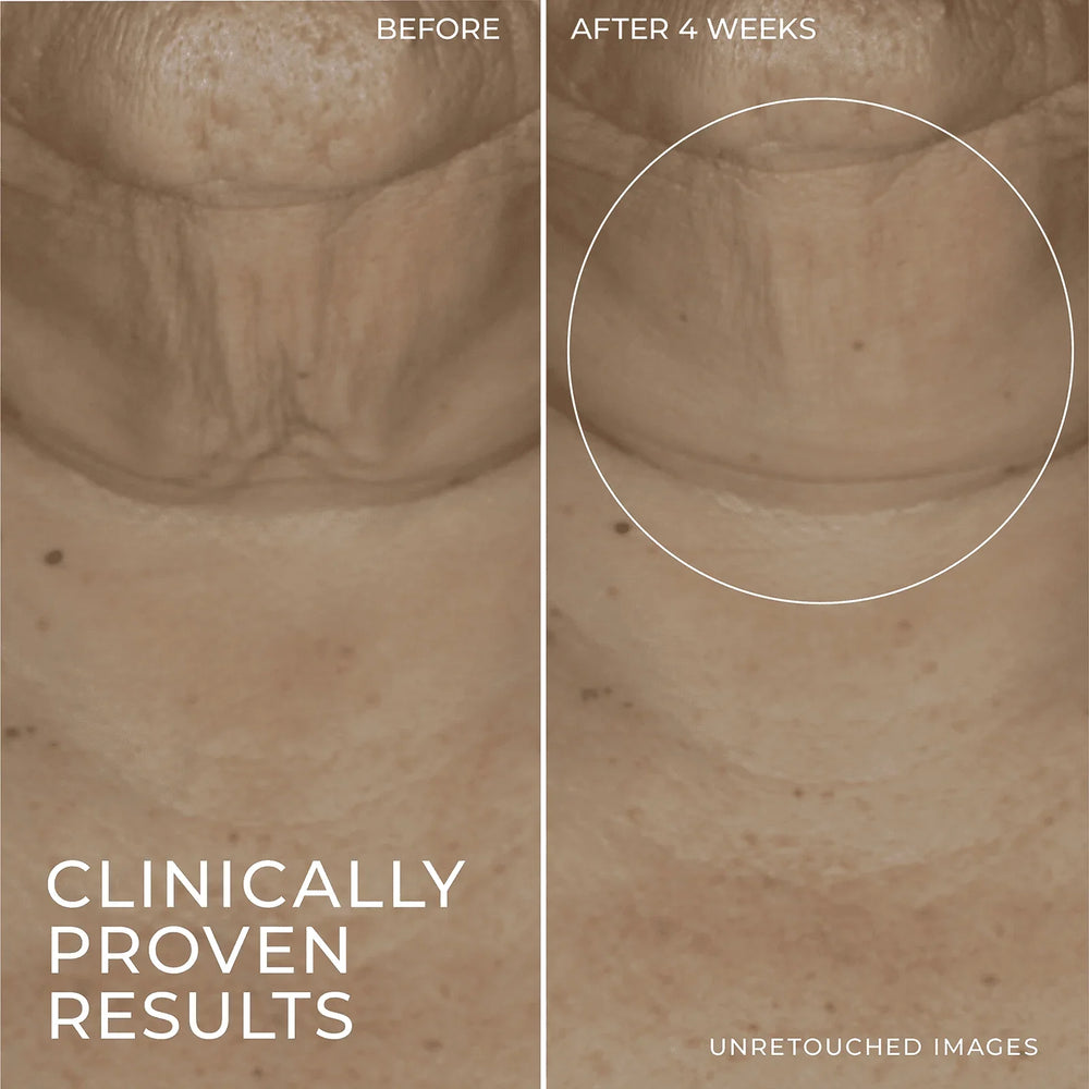 RoC Skincare Derm Correxion Firming Retinol Serum Stick - Kenya