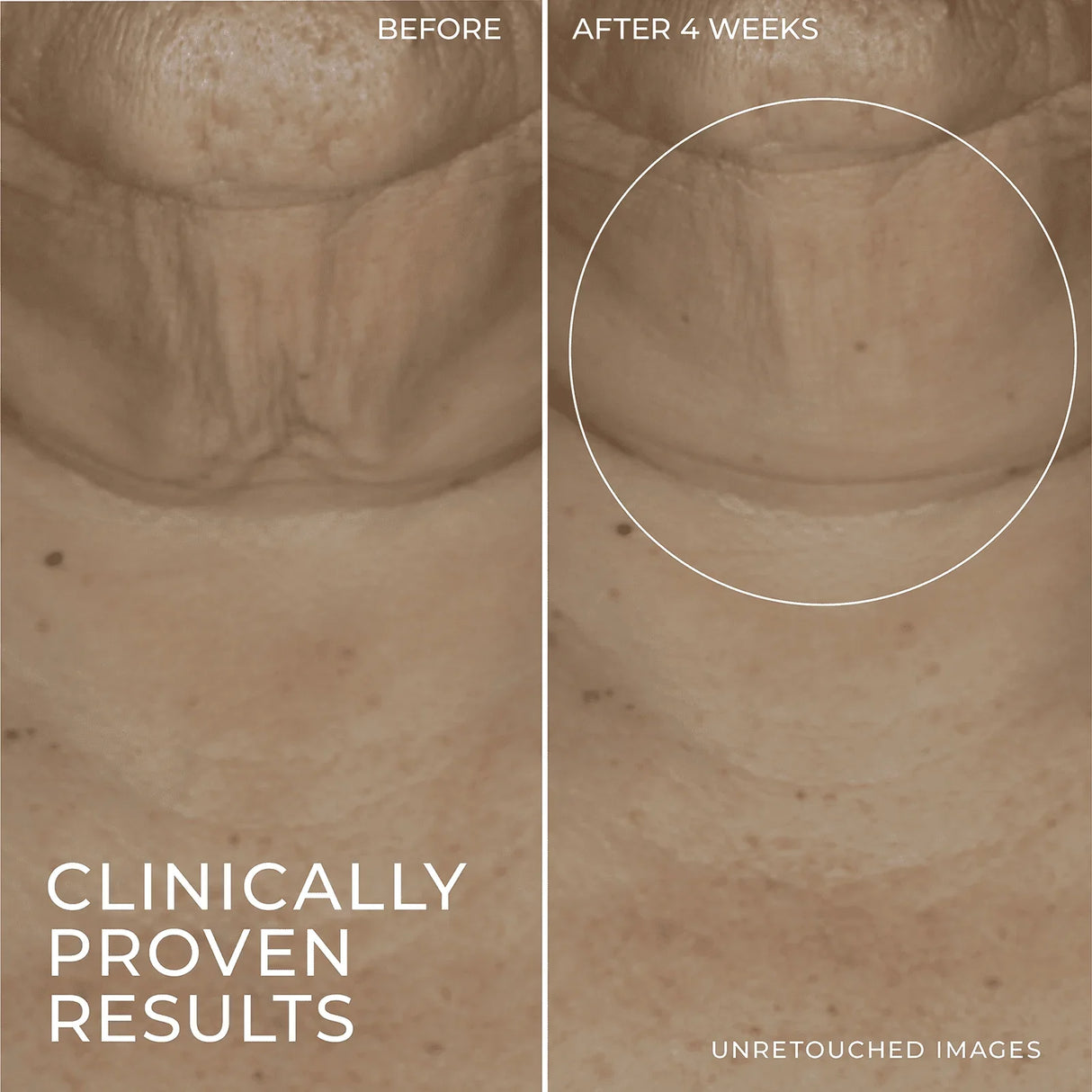 RoC Skincare Derm Correxion Firming Retinol Serum Stick - Kenya