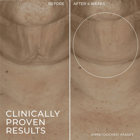 RoC Skincare Derm Correxion Firming Retinol Serum Stick - Kenya