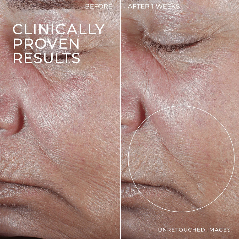 RoC Skincare Derm Correxion Firming Retinol Serum Stick - Kenya