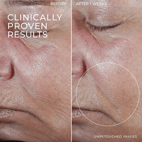 RoC Skincare Derm Correxion Firming Retinol Serum Stick - Kenya