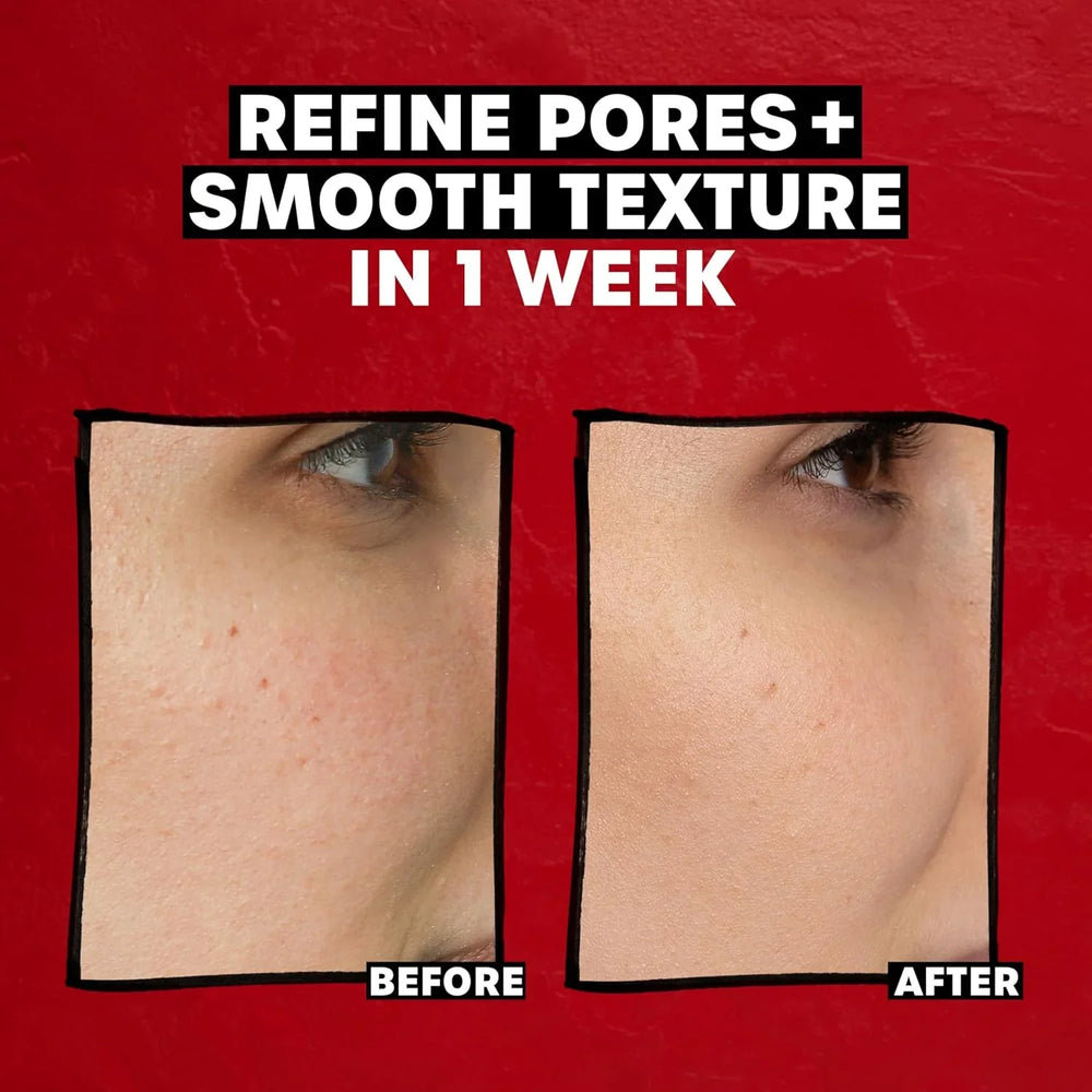 Thayers 2% AHA Exfoliating Toner with Glycolic Acid - Kenya