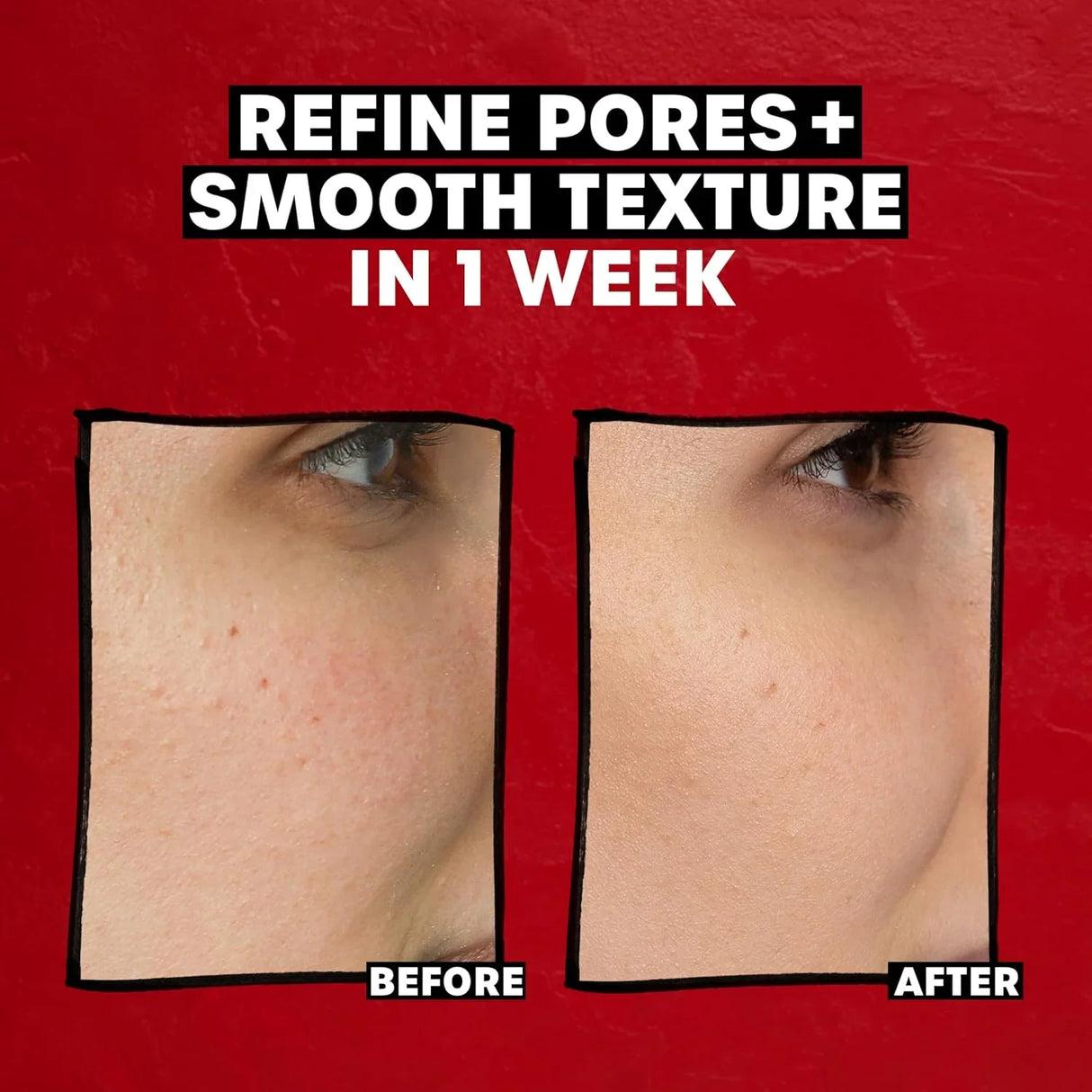 Thayers 2% AHA Exfoliating Toner with Glycolic Acid - Kenya