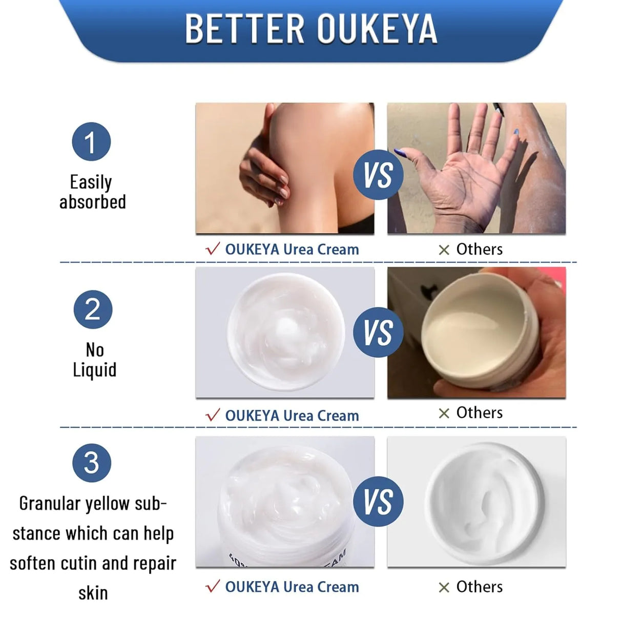 Urea Cream 40 Percent, Urea Foot & Hand Cream for Dry Cracked - Kenya