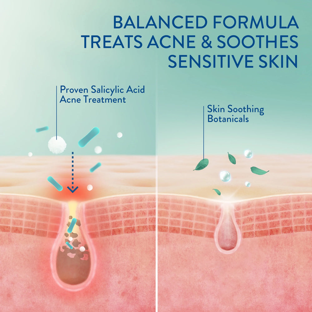 Cetaphil Gentle Clear Acne Face Cleanser + 2% Salicylic Acid - Kenya