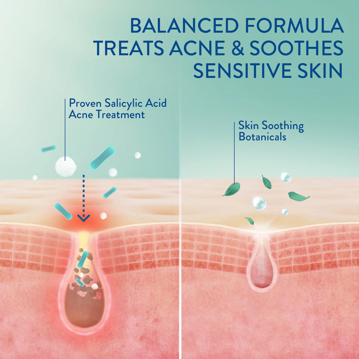 Cetaphil Gentle Clear Acne Face Cleanser + 2% Salicylic Acid - Kenya