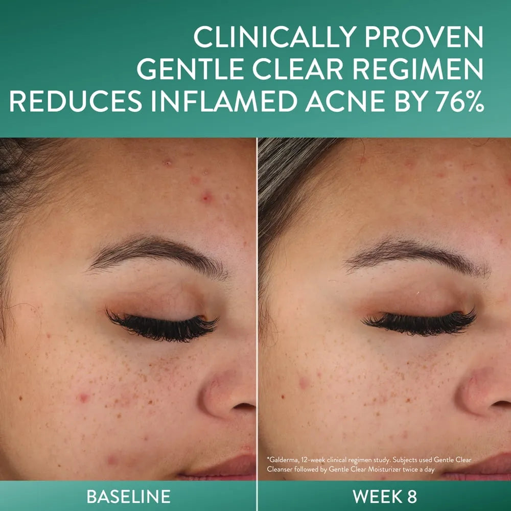 Cetaphil Gentle Clear Acne Face Cleanser + 2% Salicylic Acid - Kenya