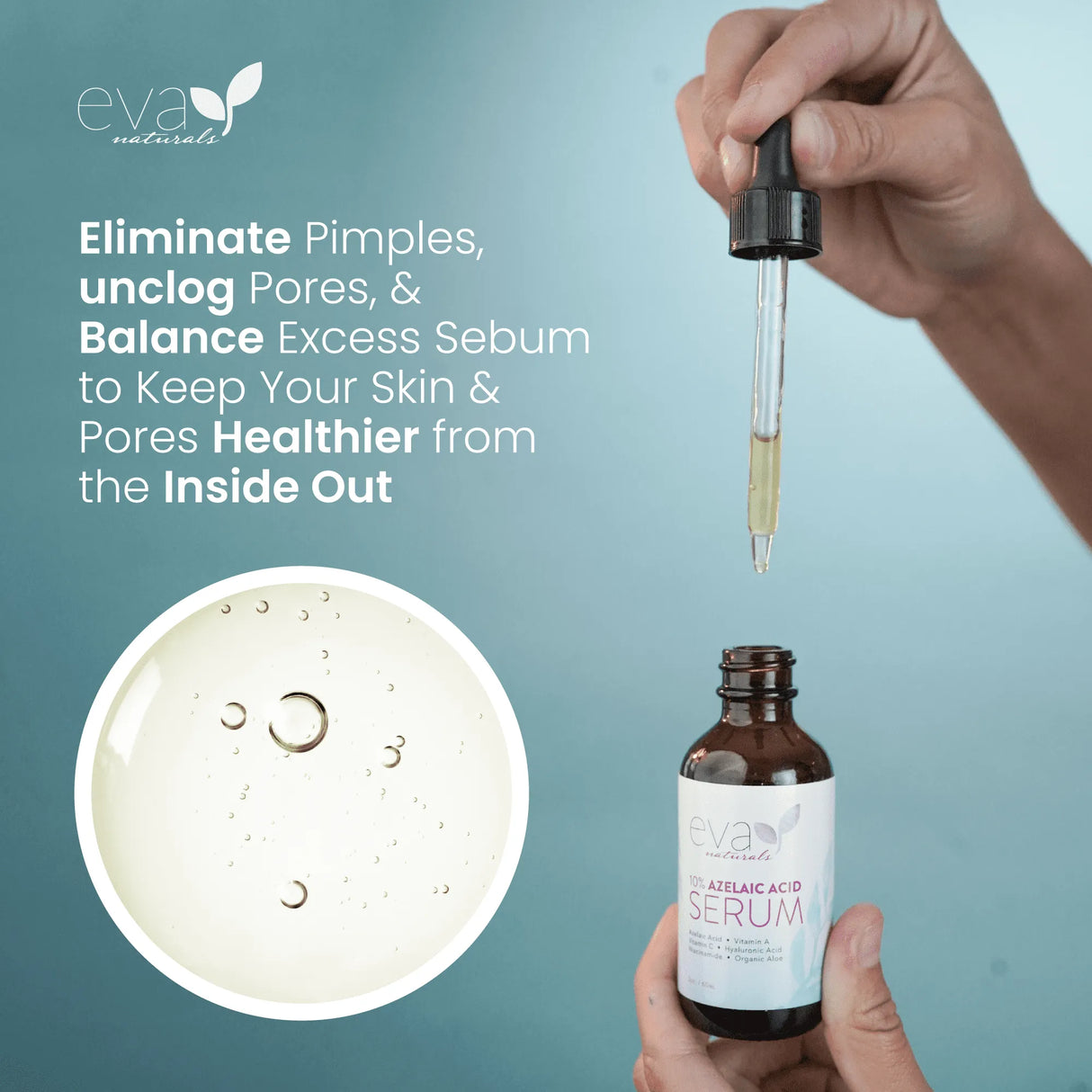 Eva Naturals Azelaic Acid 10% Facial Serum, 2 oz. - Kenya