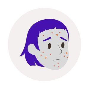 Acne Supplements - Western Cosmetics Kenya
