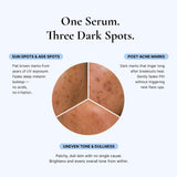 EnaSkin Dark Spot Corrector & Remover Serum for Face & Body