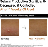 Anua Rice 70 Glow Milky Toner