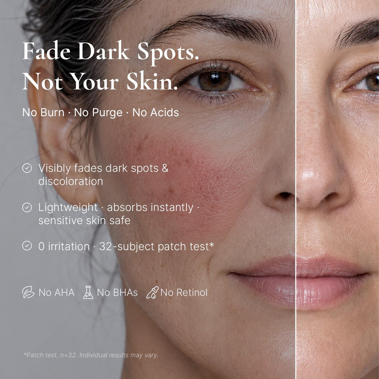 EnaSkin Dark Spot Corrector & Remover Serum for Face & Body