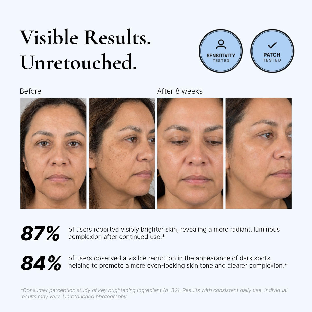 EnaSkin Dark Spot Corrector & Remover Serum for Face & Body