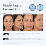 EnaSkin Dark Spot Corrector & Remover Serum for Face & Body