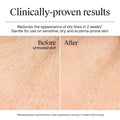 Neutrogena® Hydro Boost Water Gel image 4