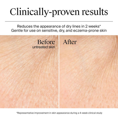 Neutrogena® Hydro Boost Water Gel - view 4
