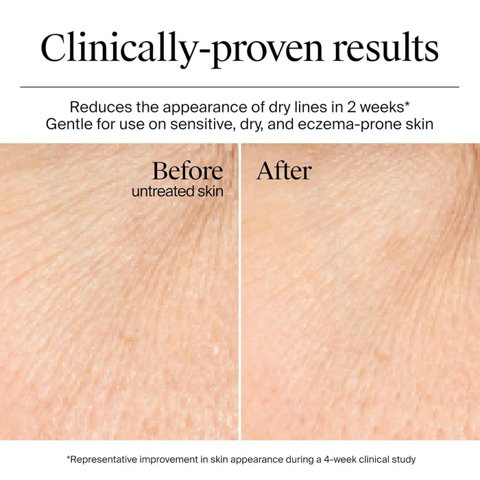 Neutrogena® Hydro Boost Water Gel