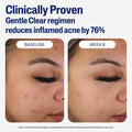 Cetaphil Face Moisturizer image 2