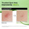 ANUA Azelaic Acid 10% Hyaluron Facial Serum image 3