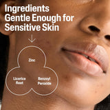 Cetaphil Cleanser  2.6% Benzoyl Peroxide