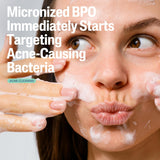 Cetaphil Cleanser  2.6% Benzoyl Peroxide