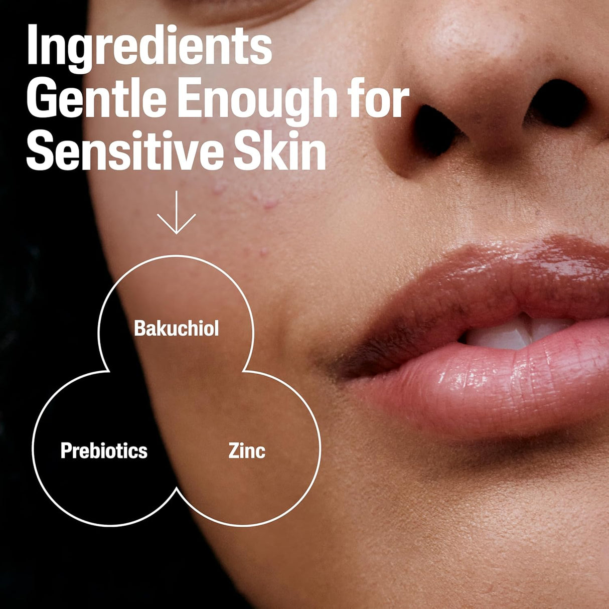 Cetaphil Post-Acne Retinol Alternative Serum